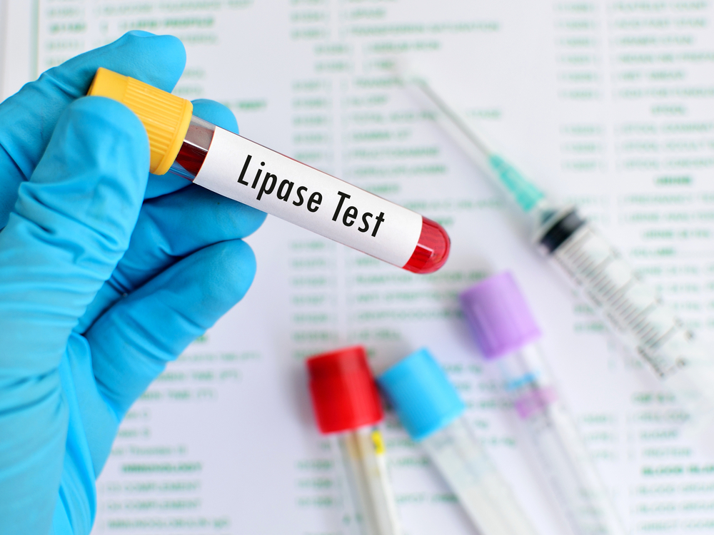 erhöhte lipase-werte